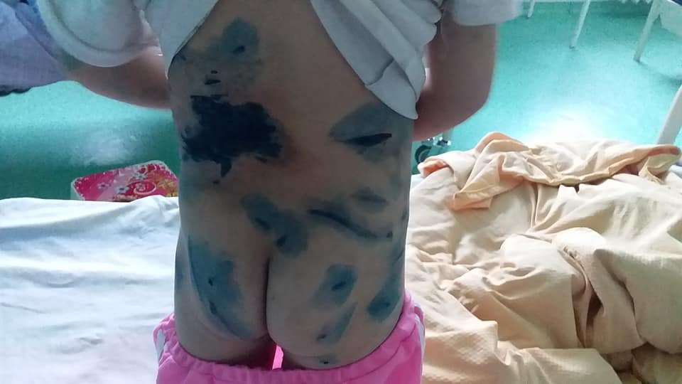 Хоёр нохойд бариулсан хоёр настай охины гэр бүлд 100 мянган төгрөг өгье гэжээ