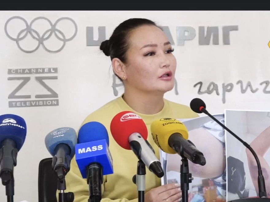 А.Өлзийням: Төв аймгийн Баянчандмань сумын засаг дарга Г.Ариунболдод зодуулснаас хойш гурван сарын хугацаанд Шүүх эмнэлгийн дүгнэлт хоёр удаа өөрчлөгдсөн