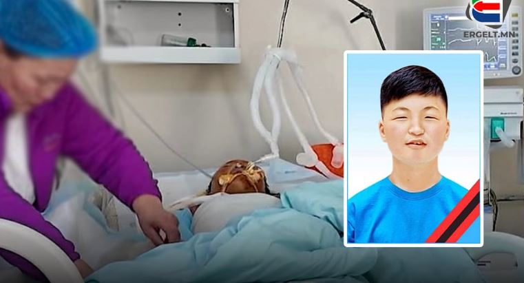 ГАЛД ӨРТСӨН ХҮҮХДҮҮДИЙН ЭМЭЭ: ДҮРЭЛЗСЭН ГАЛААС ДҮҮГЭЭ АВРААД, АМИА АЛДСАН ХҮҮГЭЭ БОДОХООР ӨР ЗҮРХ ШИМШРЭЭД БАЙХ ЮМ