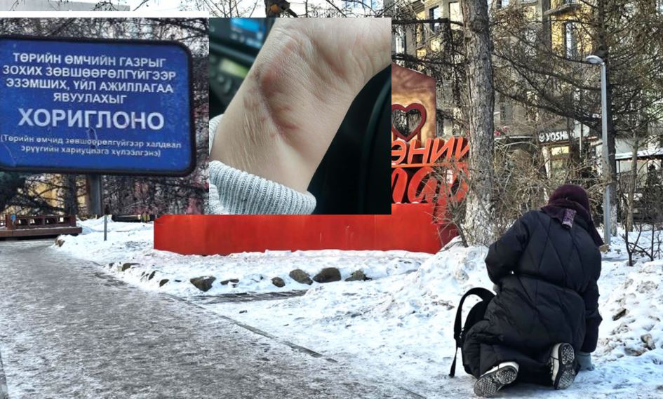 Халтирч унаж, гэмтсэн нь хохирсоор байх уу?!