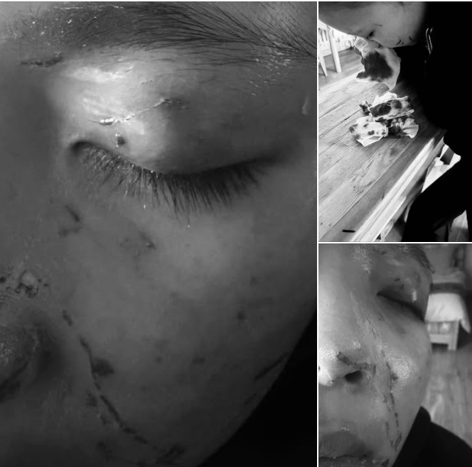 Насанд хүрээгүй хохирогч охиныг хамгаалах байранд хүргэж, шалгалтын ажиллагааг үргэлжлүүлж байна гэв