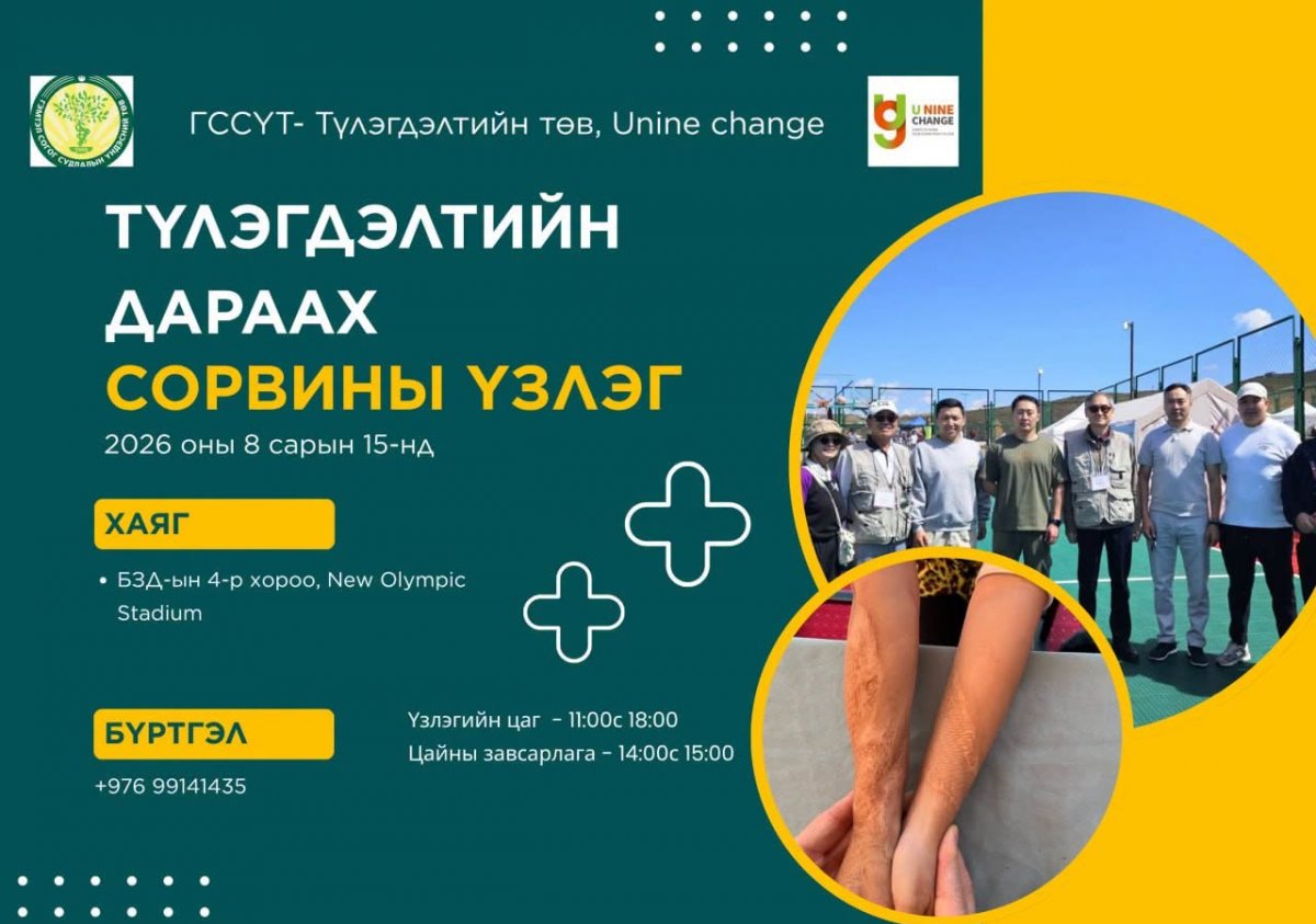 ГССҮТ: Түлэгдэлтийн дараах сорвитой иргэдэд зориулсан үнэ төлбөргүй үзлэг наймдугаар сарын 15-нд болно